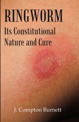 Ringworm: Its Constitutional Nature and Cure(Hardcover, J. Compton Burnett)