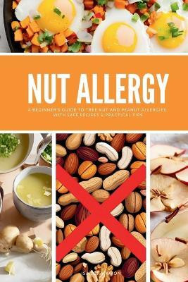 Nut Allergy(English, Paperback, Kwon Isadora)