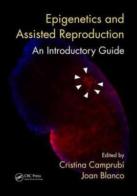 Epigenetics and Assisted Reproduction(English, Paperback, unknown)