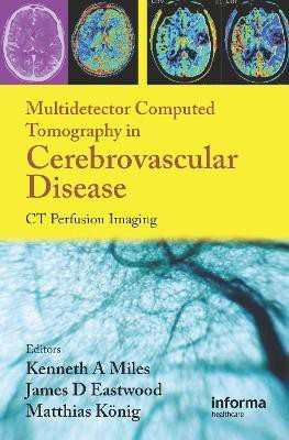 Multidetector Computed Tomography in Cerebrovascular Disease(English, Hardcover, unknown)