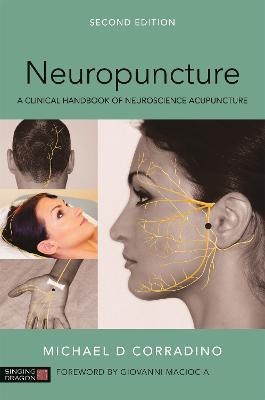 Neuropuncture(English, Electronic book text, Corradino Michael)
