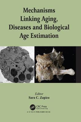 Mechanisms Linking Aging, Diseases and Biological Age Estimation(English, Electronic book text, unknown)