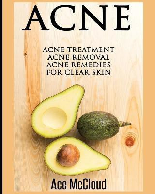 Acne(English, Paperback, McCloud Ace)