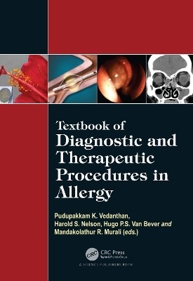 Textbook of Diagnostic and Therapeutic Procedures in Allergy(English, Hardcover, unknown)