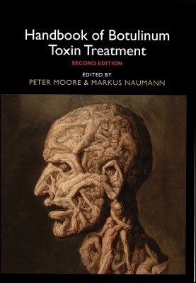 Handbook of Botulinum Toxin Treatment(English, Hardcover, unknown)