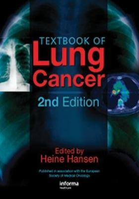 Textbook of Lung Cancer(English, Electronic book text, unknown)