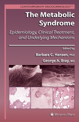 The Metabolic Syndrome:(English, Paperback, unknown)