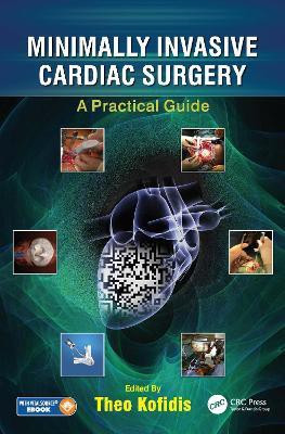 Minimally Invasive Cardiac Surgery(English, Hardcover, unknown)