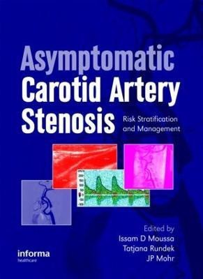 Asymptomatic Carotid Artery Stenosis(English, Hardcover, unknown)