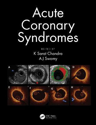Acute Coronary Syndromes(English, Electronic book text, unknown)
