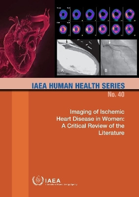 Imaging of Ischemic Heart Disease in Women(English, Paperback, IAEA)