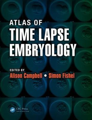 Atlas of Time Lapse Embryology(English, Paperback, unknown)