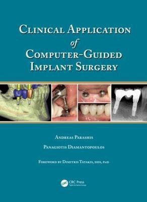 Clinical Application of Computer-Guided Implant Surgery(English, Hardcover, Parashis Andreas)