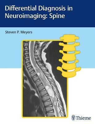 Differential Diagnosis in Neuroimaging: Spine(English, Hardcover, unknown)