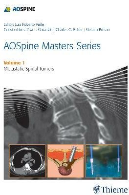 AOSpine Masters Series Volume 1: Metastatic Spinal Tumors(English, Hardcover, unknown)