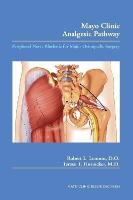 Mayo Clinic Analgesic Pathway  - Peripheral Nerve Blockade for Major Orthopedic Surgery(English, Paperback, Lennon Robert L.)