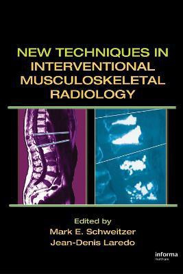 New Techniques in Interventional Musculoskeletal Radiology 1st  Edition(English, Hardcover, unknown)