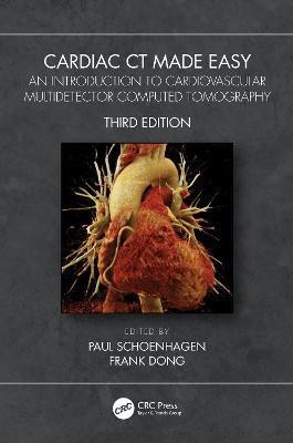 Cardiac CT Made Easy(English, Paperback, unknown)