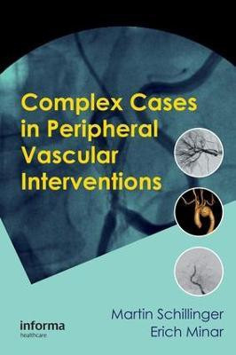 Complex Cases in Peripheral Vascular Interventions(English, Electronic book text, unknown)