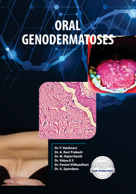 Oral Genodermatoses with 1 Disc(Paperback, Dr. T. Vaishnavi, Dr. A. Ravi Prakash, Dr. M. Rajini K, Dr. Vidya.K.S, Dr. Pavani V, Dr. G. Spandana)
