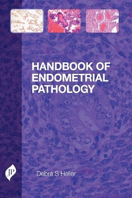 Handbook of Endometrial Pathology(English, Paperback, Heller Debra S.)