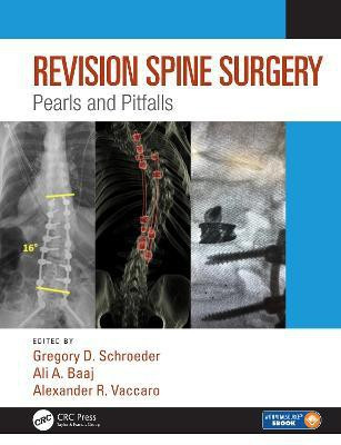 Revision Spine Surgery(English, Hardcover, unknown)