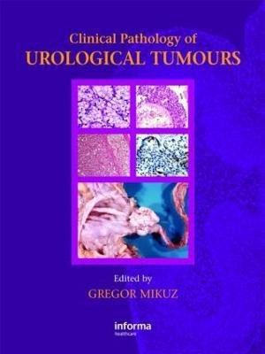 Clinical Pathology of Urological Tumours(English, Hardcover, unknown)