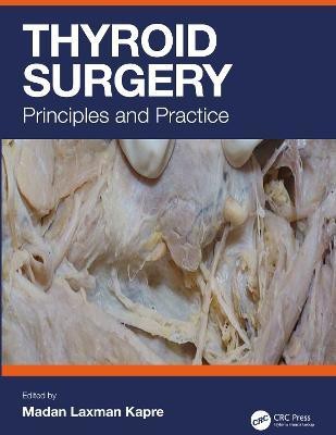 Thyroid Surgery(English, Hardcover, unknown)