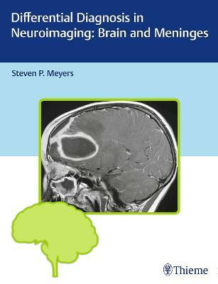 Differential Diagnosis in Neuroimaging: Brain and Meninges(English, Hardcover, unknown)