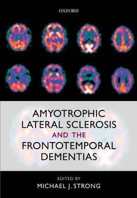 Amyotrophic Lateral Sclerosis and the Frontotemporal Dementias(English, Hardcover, unknown)