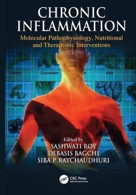 Chronic Inflammation(English, Paperback, unknown)