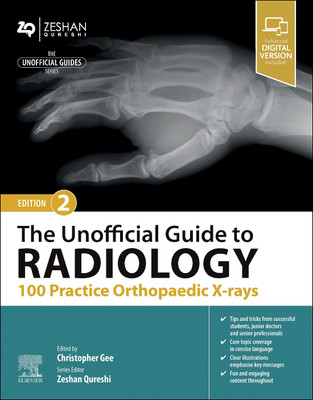 The Unofficial Guide to Radiology: 100 Practice Orthopaedic X-rays(English, Paperback, unknown)