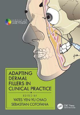 Adapting Dermal Fillers in Clinical Practice(English, Hardcover, unknown)