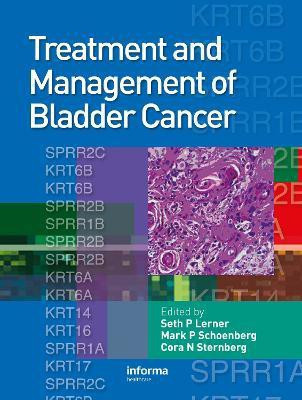 Treatment and Management of Bladder Cancer(English, Hardcover, unknown)