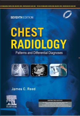 Chest Radiology: Patterns and Differential Diagnoses, 7e(Paperback, Reed, James)