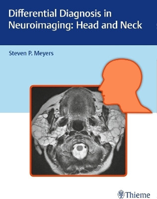 Differential Diagnosis in Neuroimaging: Head and Neck(English, Hardcover, unknown)