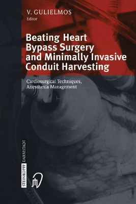 Beating Heart Bypass Surgery and Minimally Invasive Conduit Harvesting(English, Paperback, unknown)