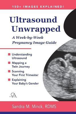 Ultrasound Unwrapped(English, Paperback, Minck Rdms Sandra M)