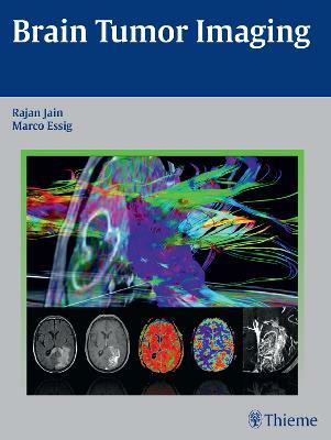 Brain Tumor Imaging(English, Hardcover, Jain Rajan)