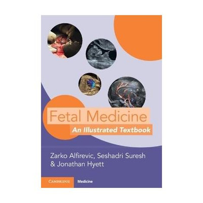 Fetal Medicine(English, Paperback, unknown)