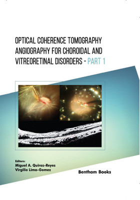 Optical Coherence Tomography Angiography for Choroidal and Vitreoretinal Disorders - Part 1(Hardcover, Miguel A. Quiroz-Reyes, Virgilio Lima-Gomez)