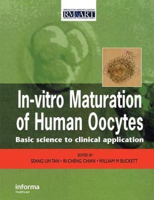 In Vitro Maturation of Human Oocytes(English, Hardcover, unknown)