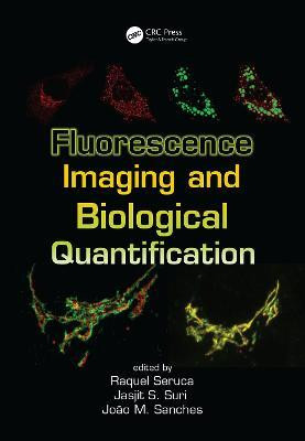 Fluorescence Imaging and Biological Quantification(English, Electronic book text, unknown)