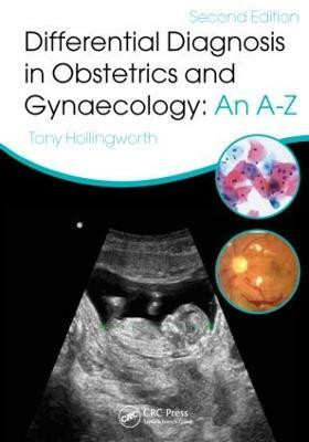 Differential Diagnosis in Obstetrics & Gynaecology(English, Hardcover, unknown)