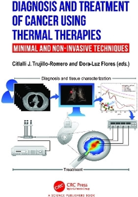 Diagnosis and Treatment of Cancer using Thermal Therapies(English, Paperback, unknown)
