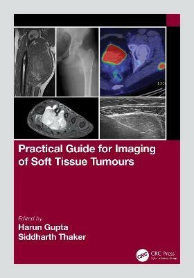 Practical Guide for Imaging of Soft Tissue Tumours(English, Paperback, unknown)