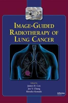 Image-Guided Radiotherapy of Lung Cancer(English, Electronic book text, unknown)