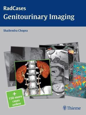 Radcases Genitourinary Imaging(English, Paperback, Chopra Shailendra)