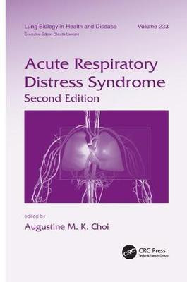 Acute Respiratory Distress Syndrome(English, Paperback, unknown)