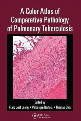 A Color Atlas of Comparative Pathology of Pulmonary Tuberculosis(English, Hardcover, unknown)
